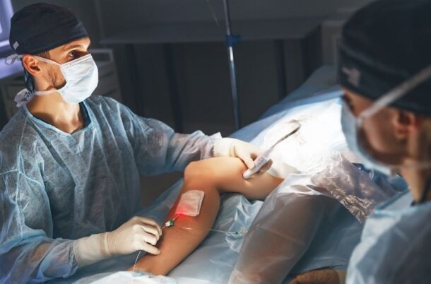 surgery for varicose veins with laser