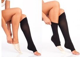 wear compression stockings for varicose veins
