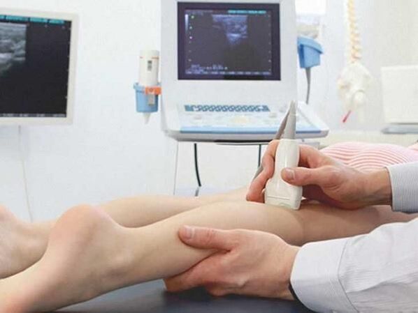 ultrasound of the lower leg veins