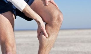 varicose veins in legs for men
